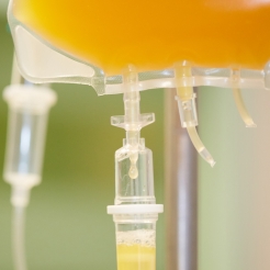 Oedeme apres radiotherapie traitement du cancer vésiculaire de los angeles thyroide