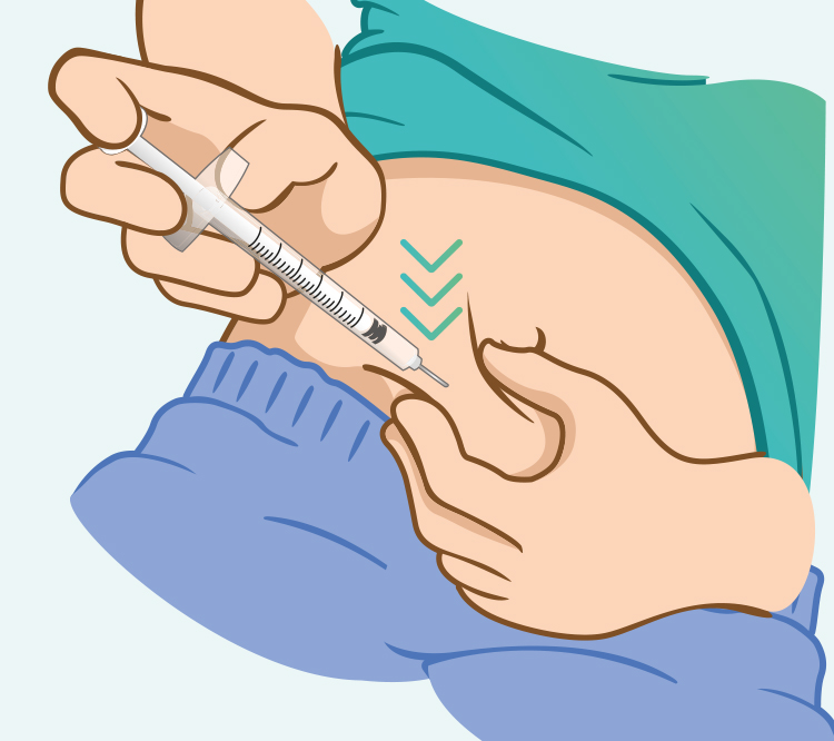 Dessin de l'injection dans le pli cutané du ventre