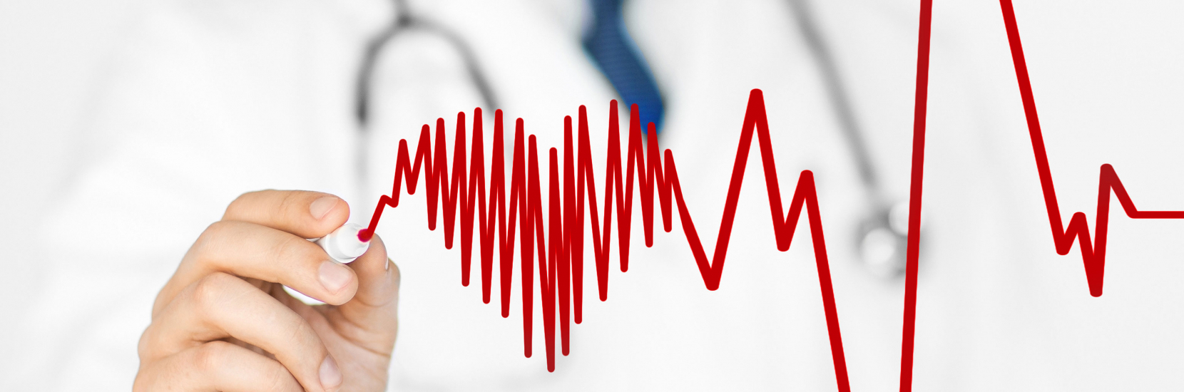 La cardioversion électrique | CHL